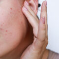 Brufoli nelle orecchie: le cause e cosa fare Benessere 