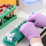 laboratory-3827743_1920-150x150 Malattie cardiache nel gentil sesso: quando le donne sono a rischio Malattie cardiache nel gentil sesso: quando le donne sono a rischio Malattie
