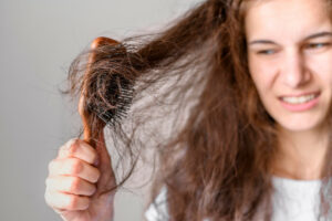 Quanti capelli si perdono al giorno? Benessere 
