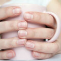 Macchie bianche sulle unghie: cause e trattamento Benessere 