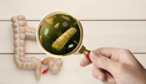 cibo-intero-nelle-feci-300x172